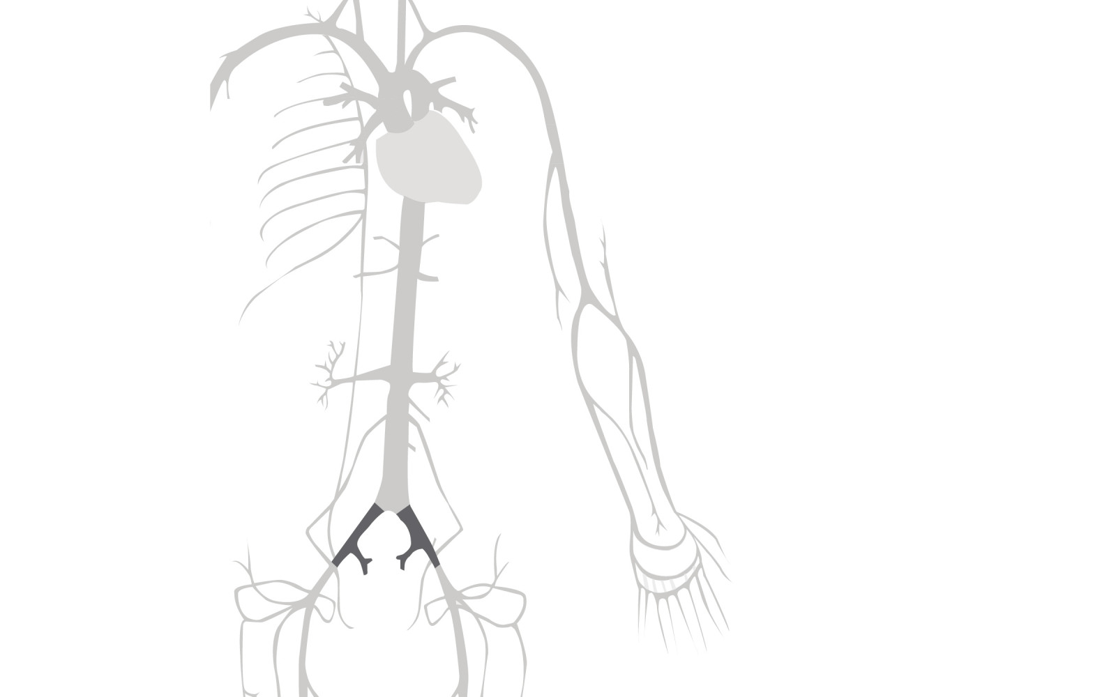 Стент BeFlow для лечения стеноза и тромбоза в подвздошной артерии